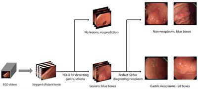 A study on the improvement in the ability of endoscopists to diagnose gastric neoplasms using an artificial intelligence system